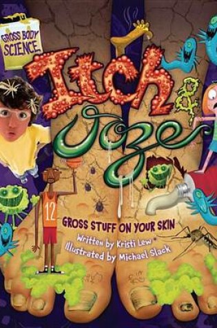 Cover of Itch & Ooze