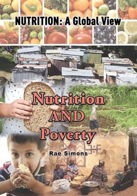Book cover for Nutrition and Poverty