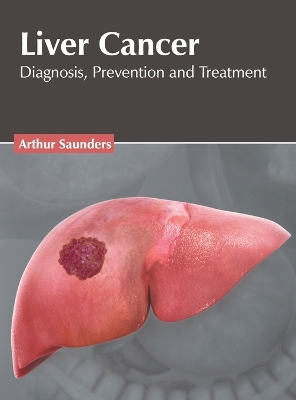 Cover of Liver Cancer: Diagnosis, Prevention and Treatment