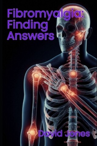 Cover of Fibromyalgia