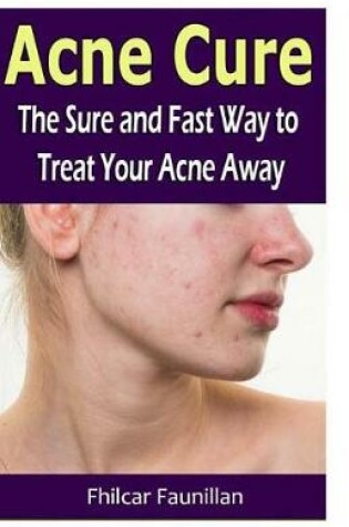 Cover of Acne Cure