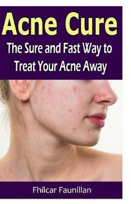 Book cover for Acne Cure