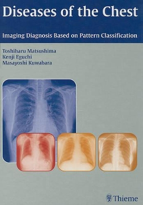 Book cover for Diseases of the Chest