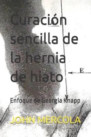 Cover of Curación sencilla de la hernia de hiato