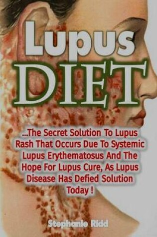 Cover of Lupus Diet