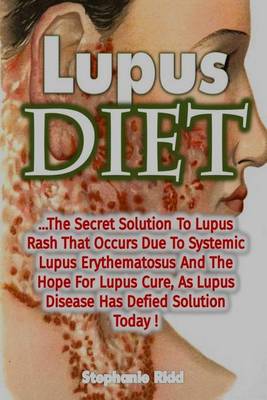 Book cover for Lupus Diet