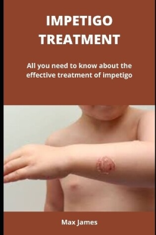 Cover of Impetigo Treatment