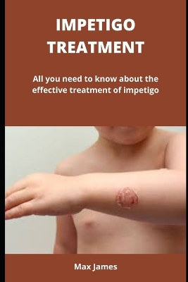 Book cover for Impetigo Treatment