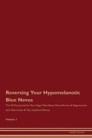 Cover of Reversing Your Hypomelanotic Blue Nevus