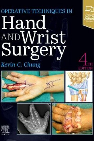 Cover of Hand and Wrist Surgery