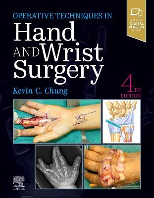 Book cover for Hand and Wrist Surgery