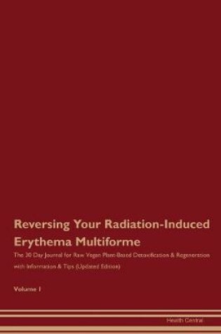 Cover of Reversing Your Radiation-Induced Erythema Multiforme