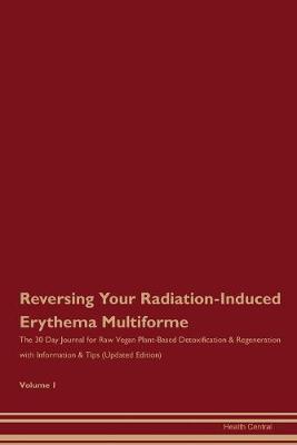 Book cover for Reversing Your Radiation-Induced Erythema Multiforme