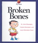 Book cover for Broken Bones