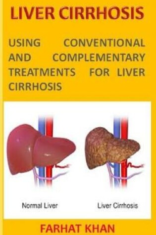 Cover of Liver Cirrhosis