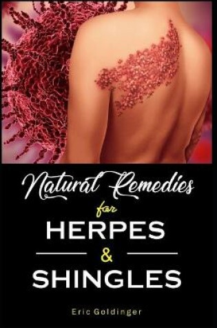 Cover of Natural Remedies For HERPES & SHINGLES