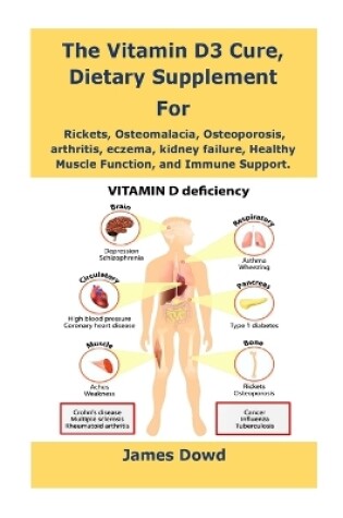 Cover of The Vitamin D3 Cure, Dietary supplement for Rickets, Osteomalacia, Osteoporosis, arthritis, eczema, kidney failure, Healthy Muscle Function, and Immune Support.