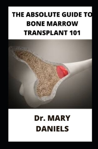 Cover of The Absolute Guide To Bone Marrow Transplant 101