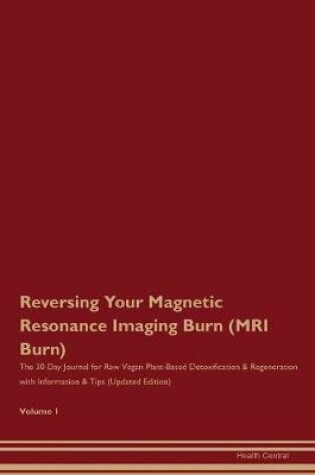 Cover of Reversing Your Magnetic Resonance Imaging Burn (MRI Burn)