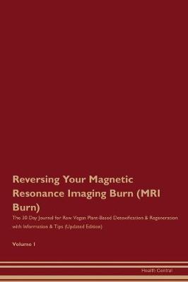 Book cover for Reversing Your Magnetic Resonance Imaging Burn (MRI Burn)