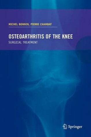Cover of Osteoarthritis of the Knee