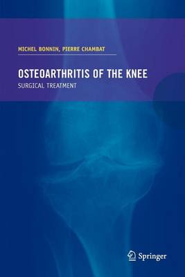 Book cover for Osteoarthritis of the Knee