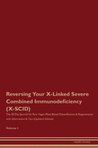 Cover of Reversing Your X-Linked Severe Combined Immunodeficiency (X-SCID)