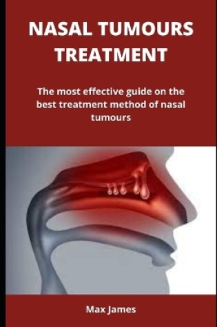 Cover of Nasal Tumours Treatment