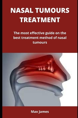 Book cover for Nasal Tumours Treatment