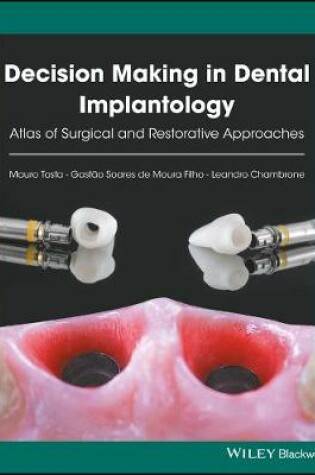 Cover of Decision Making in Dental Implantology