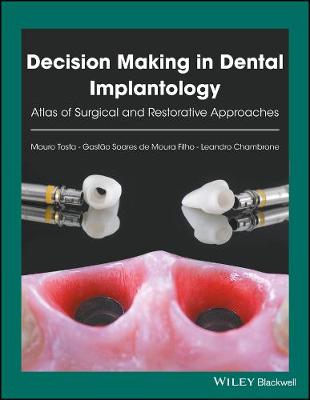 Book cover for Decision Making in Dental Implantology