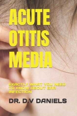 Cover of Acute Otitis Media