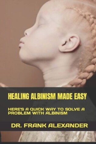 Cover of Healing Albinism Made Easy