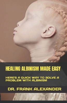 Book cover for Healing Albinism Made Easy