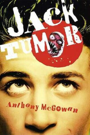 Cover of Jack Tumor