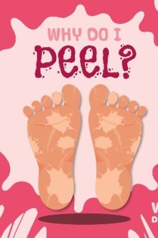 Cover of Why Do I Peel?