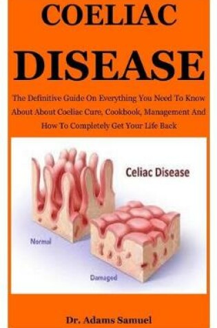 Cover of Coeliac Disease