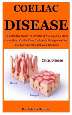 Book cover for Coeliac Disease