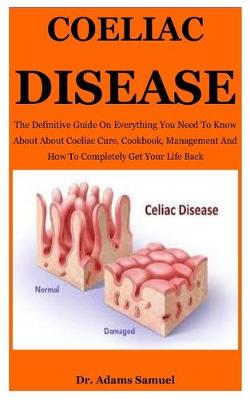 Cover of Coeliac Disease