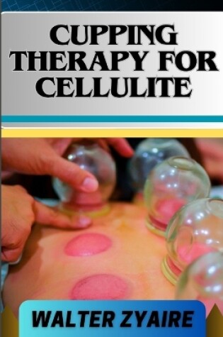 Cover of Cupping Therapy for Cellulite