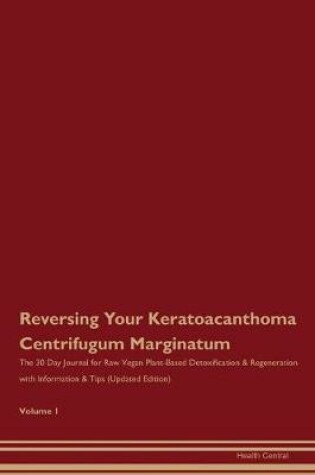 Cover of Reversing Your Keratoacanthoma Centrifugum Marginatum