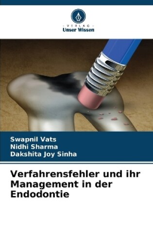 Cover of Verfahrensfehler und ihr Management in der Endodontie