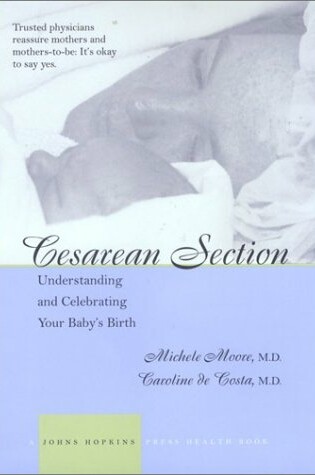 Cover of Cesarean Section