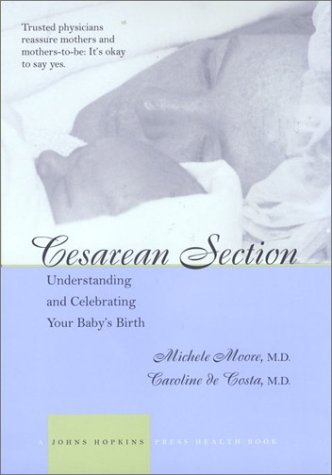 Cover of Cesarean Section