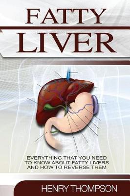 Book cover for Fatty Liver