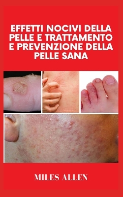 Book cover for Effetti Nocivi Della Pelle E Trattamento E Prevenzione Della Pelle Sana