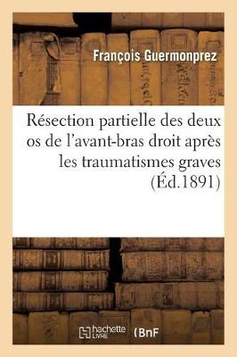 Book cover for Resection Partielle Des Deux OS de l'Avant-Bras Droit Apres Les Traumatismes Graves