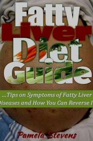 Cover of Fatty Liver Diet Guide: Tips On Symptoms of Fatty Liver Diseases and How You Can Reverse It!