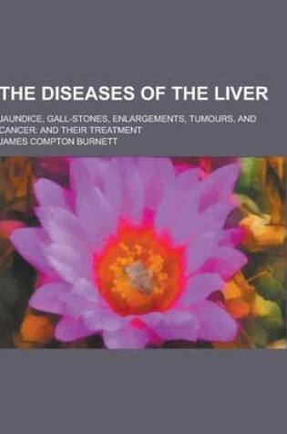 Cover of The Diseases of the Liver; Jaundice, Gall-Stones, Enlargements, Tumours, and Cancer