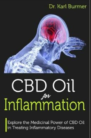 Cover of CBD Oil for Inflammation